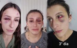 VÍDEO: maquiadora usa redes sociais para denunciar agressões do namorado em SMO