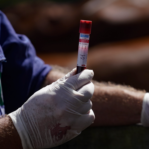 Cidasc de Iporã do Oeste alerta para prazos de exames de tuberculose