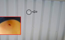 PM explica ocorrência de menina atingida por bala perdida em SMO