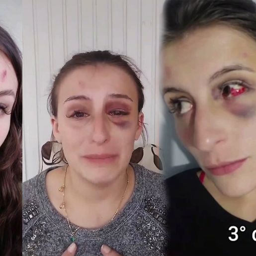 VÍDEO: maquiadora usa redes sociais para denunciar agressões do namorado em SMO