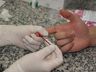 Saúde trabalha na prevenção das Hepatites Virais em SMO 