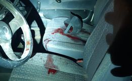 Vítima de disparo de arma de fogo morre no hospital 