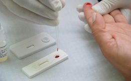 Anvisa aprova realização de testes rápidos de coronavírus em farmácias 