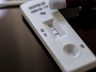 Testes positivos de Covid-19 em farmácias de SC aumentam 124% em novembro