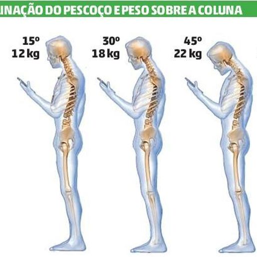 Uso incorreto do celular pode causar danos na coluna cervical