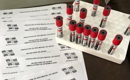 SMOeste registra 37 novos casos de Covid-19 apenas nesta semana