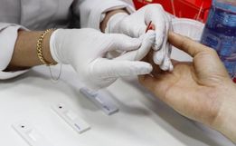 Unoesc inicia exames gratuitos para diagnóstico de Hepatite C