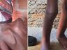 Menino acorrentado em tambor segue internado e deverá ir a abrigo