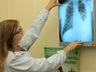 Extremo Oeste registra 26 casos de tuberculose em 2024, superando total de 2023