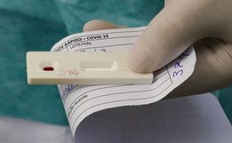 Vital Brazil e UFRJ testam soro para tratar COVID-19