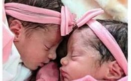 Recém-nascidas gêmeas morrem após serem atacadas por cachorro da família na Bahia