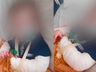 Hospital Regional apura caso de bebê que teve braço quebrado durante internação