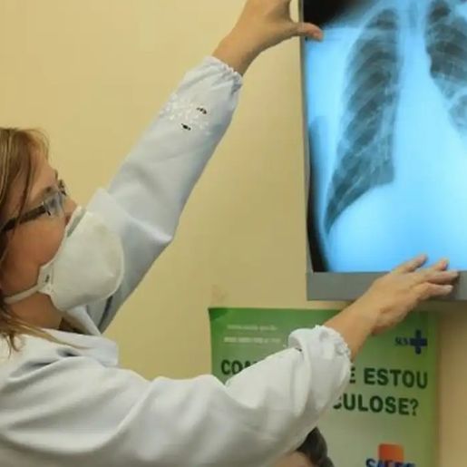 Extremo Oeste registra 26 casos de tuberculose em 2024, superando total de 2023