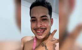 Jovem faz post para achar dente perdido e viraliza na web