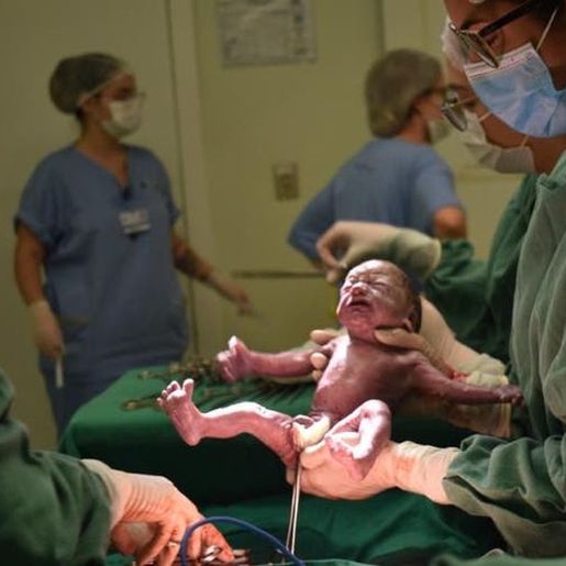 Em caso raro, mãe dá à luz trigêmeos idênticos em SC
