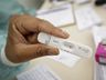 Brasil registra cerca de 110 mil casos de Covid em 2025