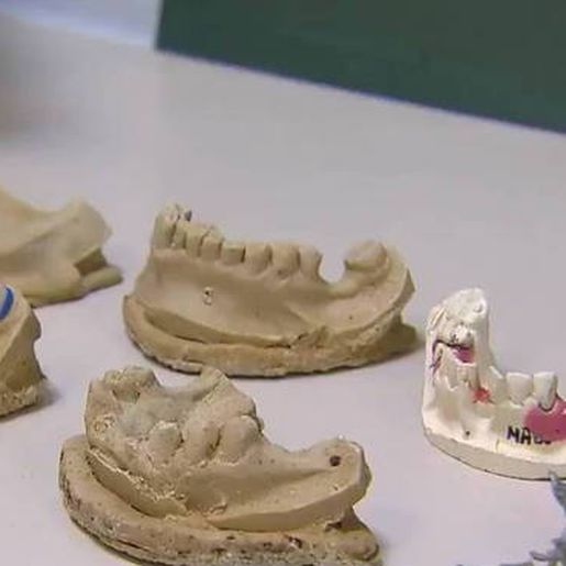 Homens vendiam próteses dentárias roubadas de cadáveres em consultórios