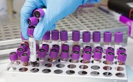 Hepatite misteriosa em crianças deixa governo de SC em alerta