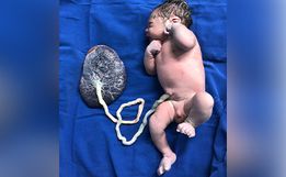 Primeiro bebê nascido em São Miguel do Oeste em 2022 é um menino