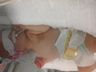 Família de São Bernardino pede ajuda para tratamento da filha com doença rara 