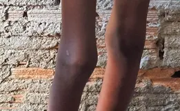 Menino aguarda adoção 2 anos após ser acorrentado a barril