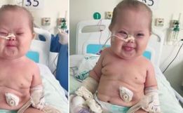 Bebê com síndrome de Down que é fenômeno da internet se recupera da Covid-19