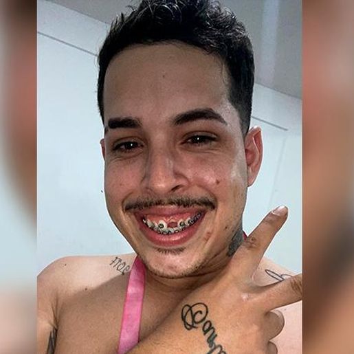 Jovem faz post para achar dente perdido e viraliza na web