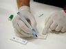 Hepatite B em gestantes deve ser obrigatoriamente notificada, define Ministério da Saúde