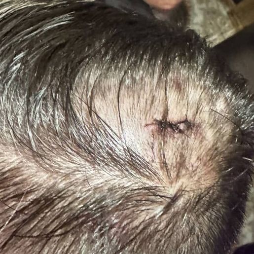 Polícia Civil identifica agressor envolvido em briga na Oktoberfest em menos de 24 horas