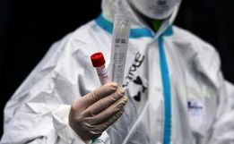 "Somos todos suscetíveis", alerta infectologista sobre coronavírus