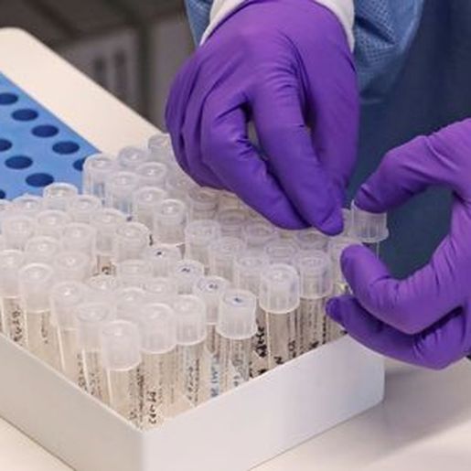 MP apura se pessoas com sintomas de COVID-19 estão realizando testes na Capital
