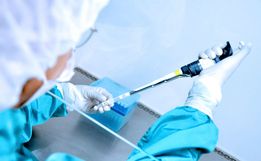 São Miguel do Oeste pode adquirir até 2 mil testes rápidos de Covid-19