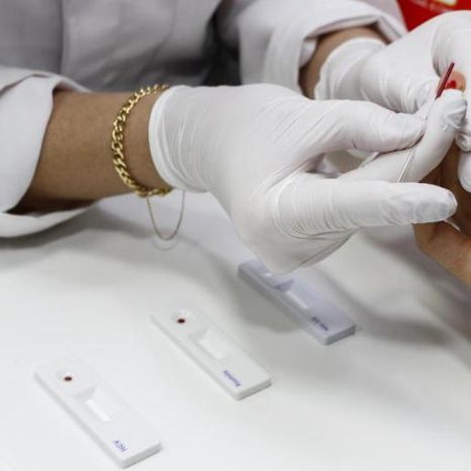 Unoesc inicia exames gratuitos para diagnóstico de Hepatite C