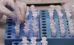 São Miguel do Oeste não registra nenhum novo caso de COVID-19 em 24h