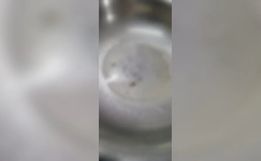 Criança é atendida com larvas na cabeça em hospital de SC, diz PM