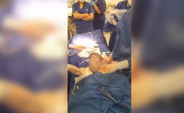 Gêmeo nasce empelicado em parto raro no Oeste; pais de Tunápolis comemoram