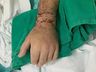 Homem tem mão reimplantada após colocá-la em gelo em Santa Catarina