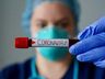 SMO: Somente pacientes graves coletarão exames para Coronavírus