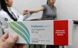Método contraceptivo que pode custar até R$ 4 mil chega no SUS de SC a partir de outubro