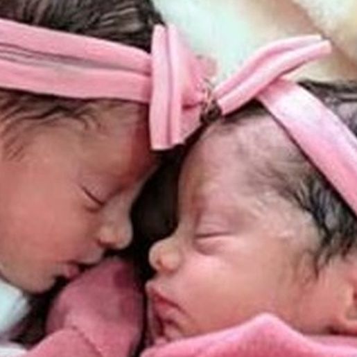 Recém-nascidas gêmeas morrem após serem atacadas por cachorro da família na Bahia