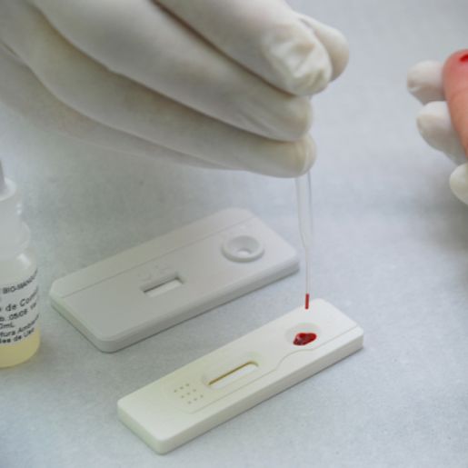 Anvisa aprova realização de testes rápidos de coronavírus em farmácias 