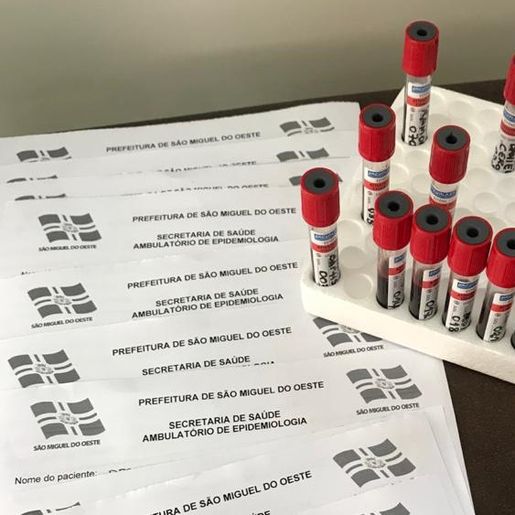 SMOeste registra 37 novos casos de Covid-19 apenas nesta semana